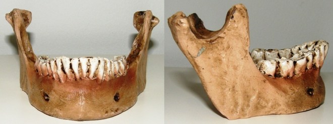 mandible