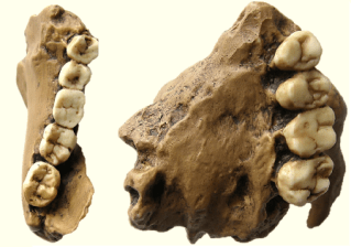 Paranthropus robustus TM1517 maxilar y mandibula