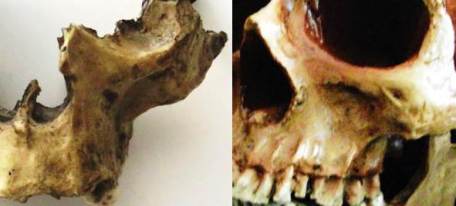 Homo antecessor fosa canina