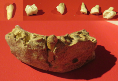 Neandertal mandible and teeth from Cueva Des-Cubierta