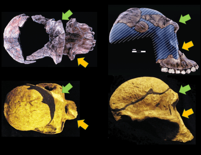 Au garhi v. Au africanus