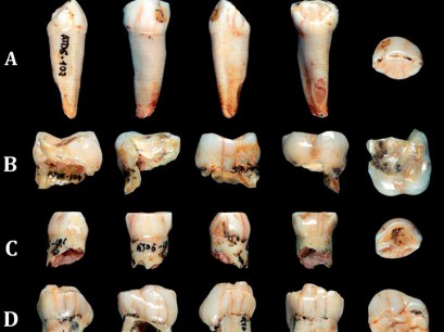 Dientes Gran Dolina TD6, Atapuerca
