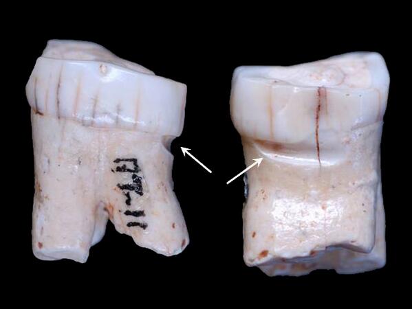 Usamos palillos de dientes desde hace 2 millones de&nbsp;años