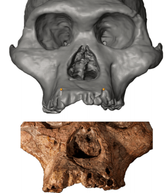 Mrs. Ples Sts 5 canine alveoli