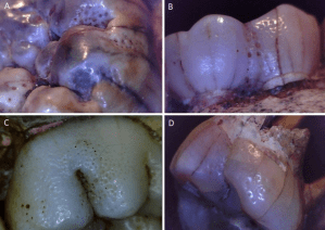 Hipoplasia Paranthropus robustus