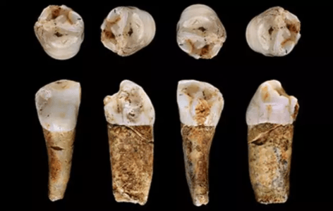 Premolar neandertal de Almonda